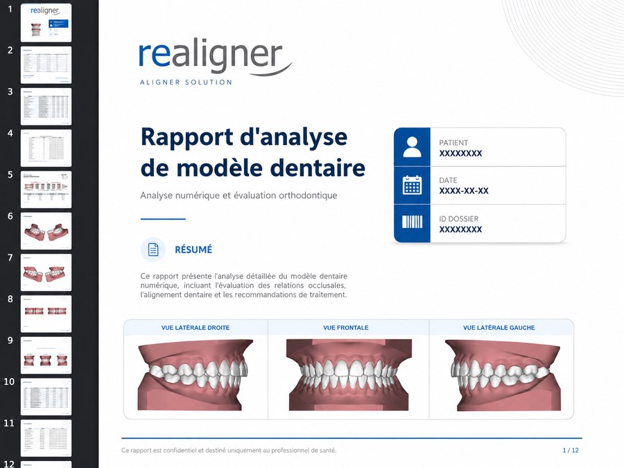 Rapport d'analyse de modèle dentaire REALIGNER